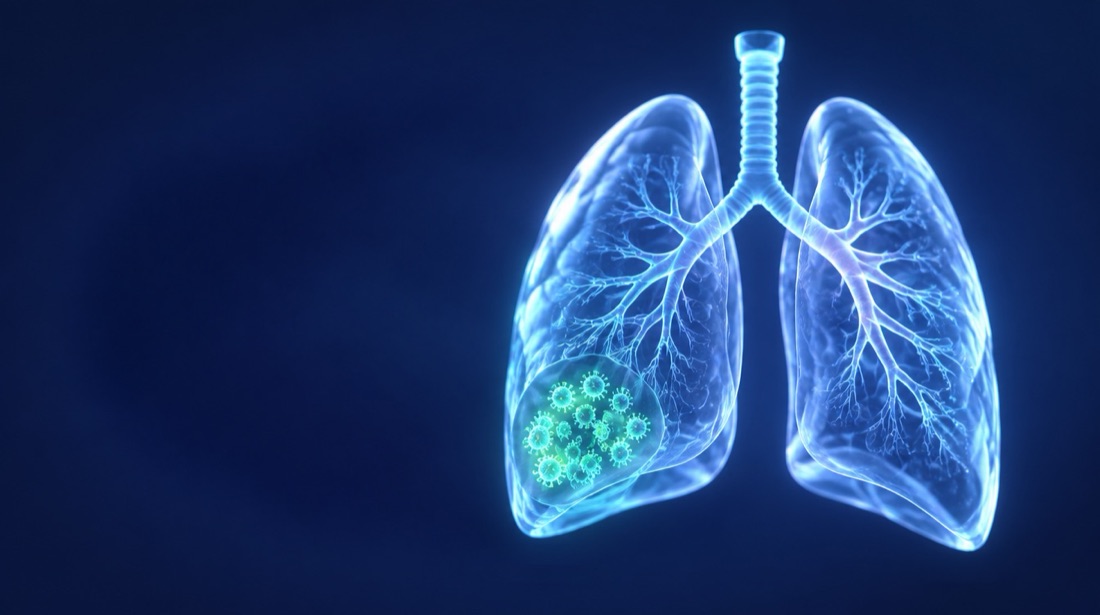 A 3D render of human lungs with a hidden pocket of SARS-CoV-2 virus particles inside the lower lobe, a viral reservoir